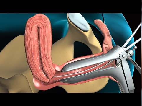 Toma de biopsia