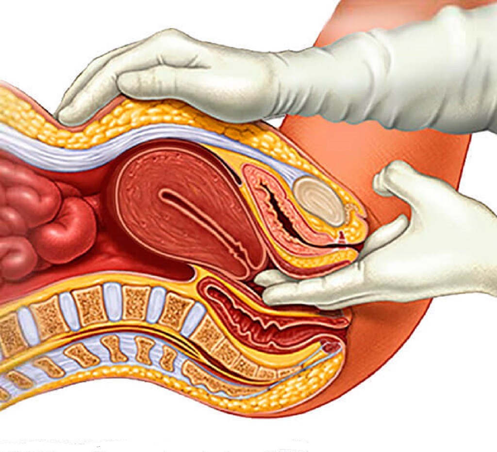 Sequedad vaginal
