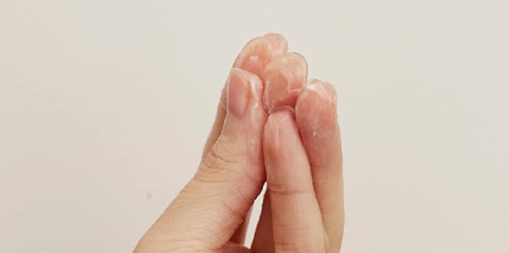 flujo vaginal
