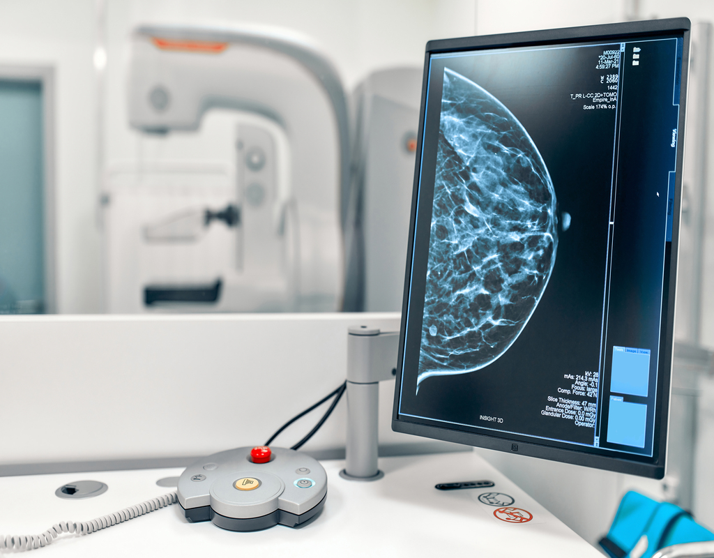 diferencia entre una mamografía y una ecografía de mama